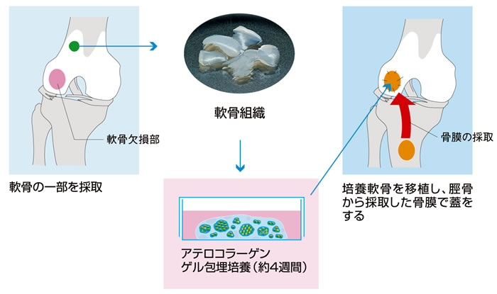 図２　細胞分離から組織移植までの流れ