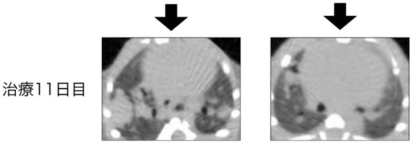 図２（治療１１日目）