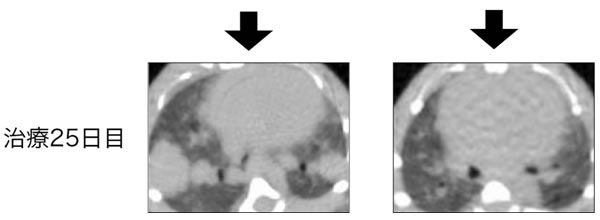 図２（治療２５日目）