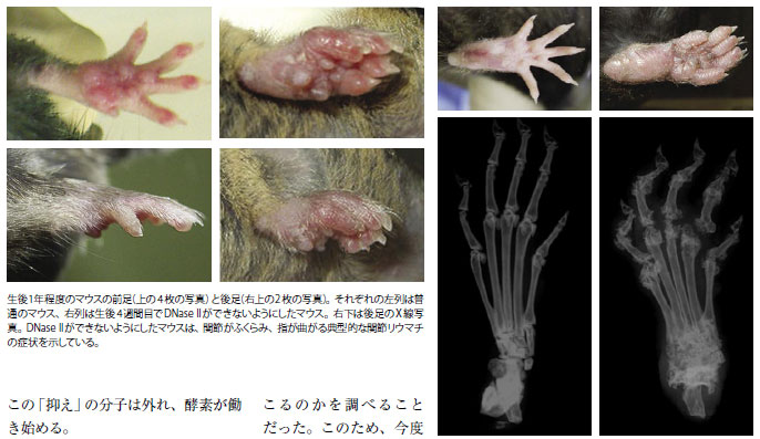 研究の積み重ねで解明 アポトーシス異常はリウマチの一因