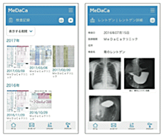 Featureの写真