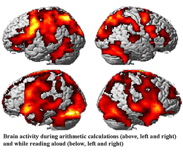 Brain activity during arithmetic calculations (above, left and right) and while reading aloud (below, left and right)