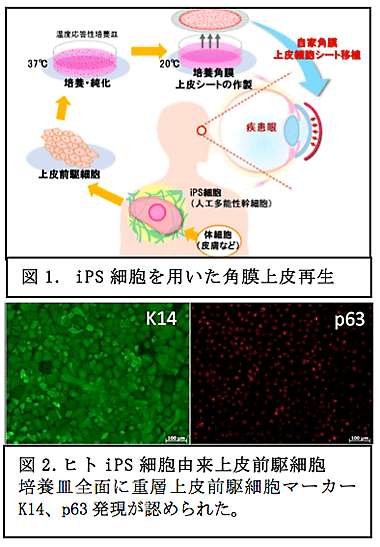 研究者 研究内容 再生医療の実現化ハイウェイ