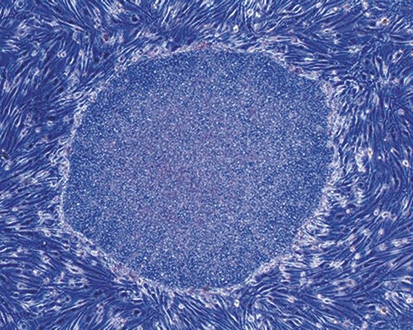 画像：ヒトの皮膚細胞から生み出された人工多能性幹細胞（iPS細胞）