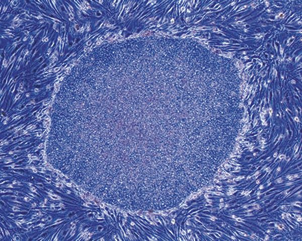 画像:ヒトの皮膚細胞から生み出された人工多能性幹細胞(iPS細胞)