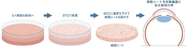 図：細胞シートを使用した角膜上皮移植の概念図