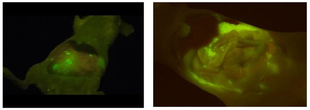 画像：がん部位の蛍光検出画像