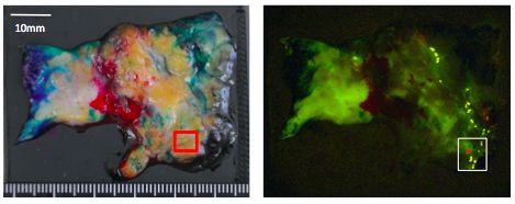 画像：蛍光試薬による手術検体中の小さながんの検出