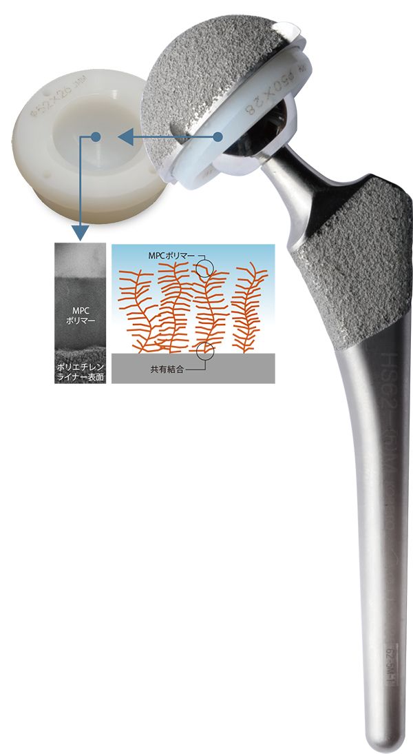 画像：ポリエチレン表面にMPCポリマー層を形成した人工股関節